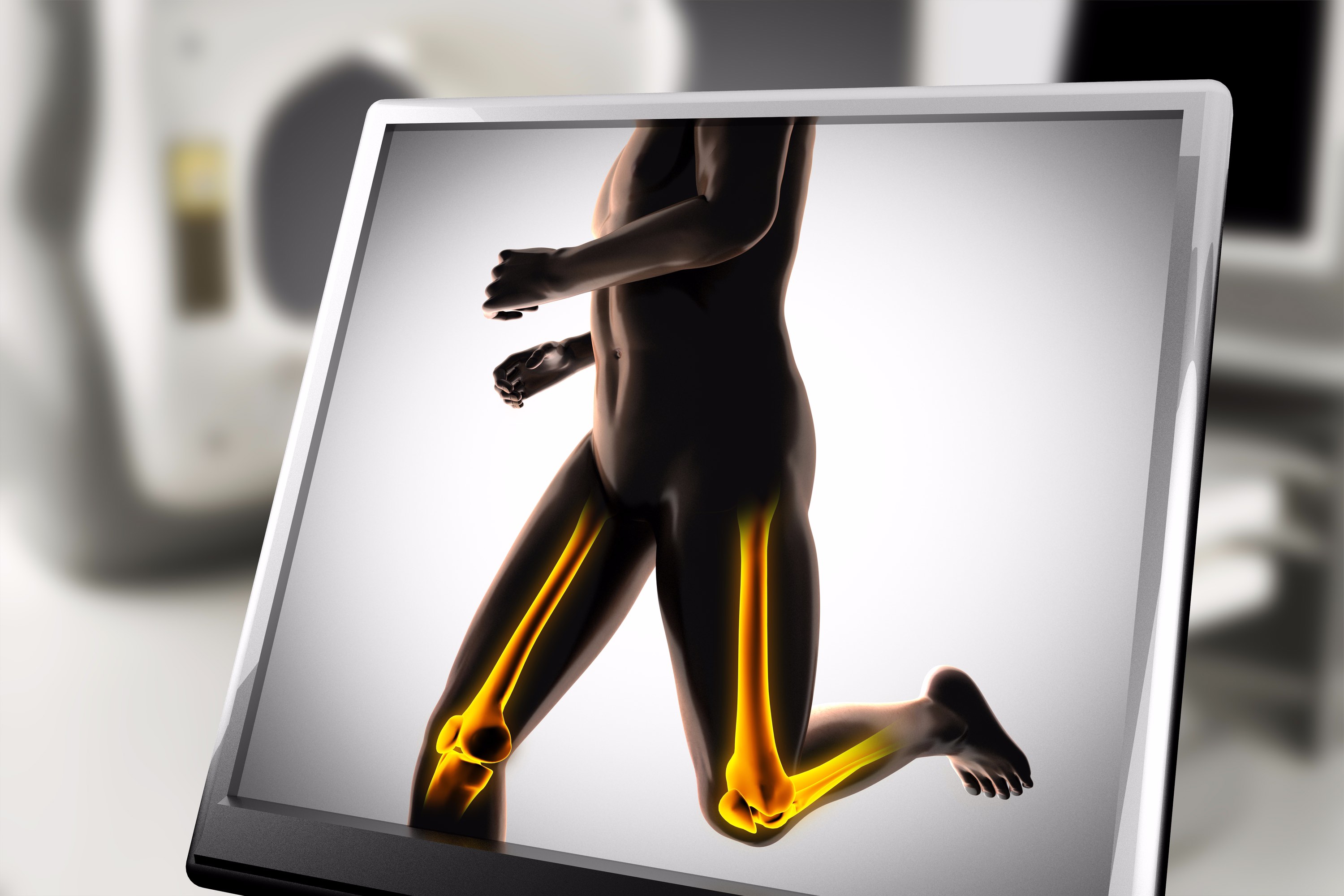 High-Impact-Training schützt vor Osteoporose